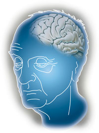 Alzheimer's and Dementia Diagnosis